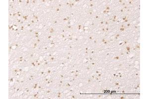 Immunoperoxidase of monoclonal antibody to MDM2 on formalin-fixed paraffin-embedded human cerebral cortex. (MDM2 antibody  (AA 101-200))