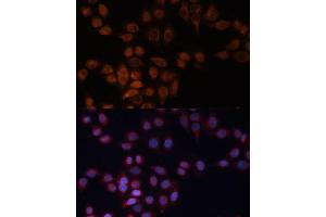 Immunofluorescence analysis of HeLa cells using  Polyclonal Antibody (ABIN6131157, ABIN6136523, ABIN6136524 and ABIN6223703) at dilution of 1:100 (40x lens).