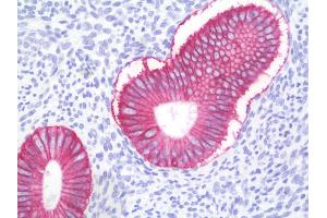 Anti-ESA / EPCAM antibody IHC staining of human uterus, endometrium. (EpCAM antibody)
