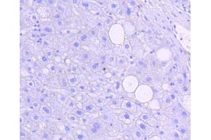 Immunohistochemistry of paraffin-embedded human liver using Phospho-JNK1/2/3-T183/T183/T221 antibody (abx125450) at dilution of 1/100 (40x lens). (SMAD2 antibody  (pThr183, pThr221))