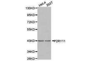 Western Blotting (WB) image for anti-Purinergic Receptor P2Y, G-Protein Coupled, 11 (P2RY11) antibody (ABIN1874013) (P2RY11 antibody)