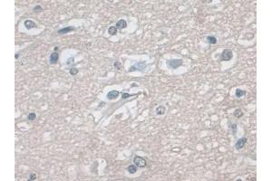 Immunohistochemistry (IHC) image for anti-Mitogen-Activated Protein Kinase 3 (MAPK3) (AA 75-312) antibody (ABIN7433528)