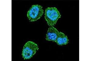 Confocal immunofluorescent analysis of LKB1 antibody with ZR-75-1 cells followed by Alexa Fluor 488-conjugated goat anti-rabbit lgG (green). (LKB1 antibody  (AA 19-48))