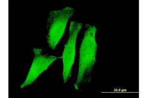 Immunofluorescence of monoclonal antibody to RNF11 on HeLa cell. (RNF11 antibody  (AA 65-154))