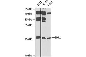 Western blot analysis of extracts of various cell lines, using GHRL antibody (ABIN3021900, ABIN3021901, ABIN3021902 and ABIN6217352) at 1:1000 dilution. (Ghrelin antibody  (AA 1-117))