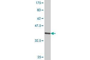 Western Blot detection against Immunogen (37 KDa) . (Sucrase Isomaltase antibody  (AA 1728-1826))