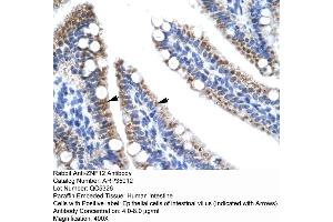 Human Intestine (ZNF12 antibody  (N-Term))