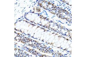 Immunohistochemistry (Paraffin-embedded Sections) (IHC (p)) image for anti-Ubiquitin-Like, Containing PHD and RING Finger Domains, 1 (UHRF1) (AA 1-260) antibody (ABIN3023232)