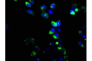 Immunofluorescence staining of Hela cells with ABIN7159444 at 1:133, counter-stained with DAPI. (Metabotropic Glutamate Receptor 6 antibody  (AA 370-531))