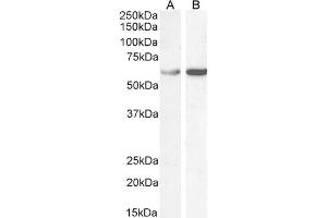 Western Blotting (WB) image for anti-T-Complex 1 (TCP1) (C-Term) antibody (ABIN185185)