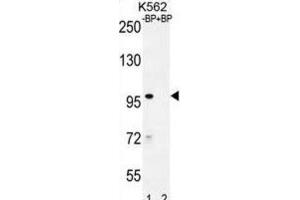 Western Blotting (WB) image for anti-IQ Motif Containing with AAA Domain 1 (IQCA1) antibody (ABIN2996486) (IQCA1 antibody)