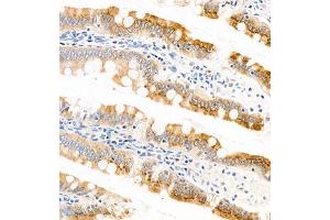 Immunohistochemistry of paraffin embedded rat small intestine using APOA4 (ABIN7073084) at dilution of 1:1200 (300x lens) (APOA4 antibody)