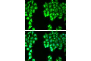 Immunofluorescence analysis of U2OS cells using MALT1 antibody (ABIN5971171). (MALT1 antibody)