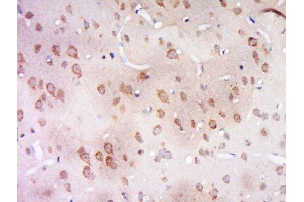 CCDC94 antibody  (AA 15-120)