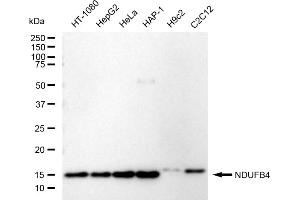 Western blotting analysis using NDUFB4 antibody (ABIN7799551).