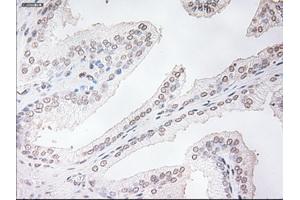 Immunohistochemical staining of paraffin-embedded prostate tissue using anti-TNNI3mouse monoclonal antibody. (TNNI3 antibody  (AA 1-210))