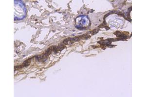 Paraformaldehyde-fixed, paraffin embedded rat spinal cord, Antigen retrieval by boiling in sodium citrate buffer (pH6) for 15min, Block endogenous peroxidase by 3% hydrogen peroxide for 30 minutes, Blocking buffer at 37°C for 20min, Antibody incubation with Cytokeratin 1 (1C2) Monoclonal Antibody  at 1:50 overnight at 4°C, followed by a conjugated secondary and DAB staining. (Cytokeratin 1 antibody)