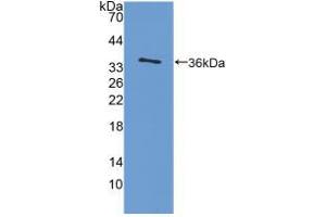 Western blot analysis of recombinant Rat IL4. (IL-4 antibody  (AA 61-111))