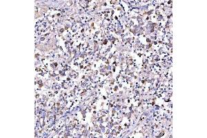 IHC analysis of SUCLG1 using anti-SUCLG1 antibody (ABIN7600906).