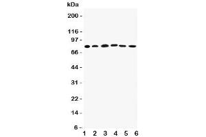 Western blot testing of Proprotein Convertase 1/3 antibody (Proprotein Convertase 1/3 (C-Term) antibody)