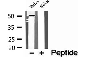 Western blot analysis of extracts of HeLa cells, using SNX17 antibody. (SNX17 antibody  (N-Term))