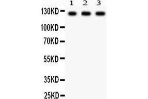 Anti-PLD1 Picoband antibody, Western blotting All lanes: Anti PLD1  at 0. (PLD1 antibody  (AA 1-330))