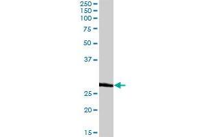 BCAP31 MaxPab rabbit polyclonal antibody. (BCAP31 antibody  (AA 1-246))