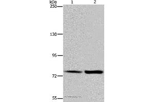 Western blot analysis of Hela and K562 cell, using GAB2 Polyclonal Antibody at dilution of 1:300 (GAB2 antibody)