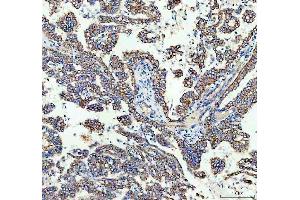 IHC analysis of TOMM20 using anti-TOMM20 antibody (ABIN7600883).