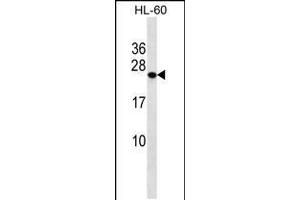 Western blot analysis in HL-60 cell line lysates (35ug/lane). (PCTP antibody  (AA 59-87))