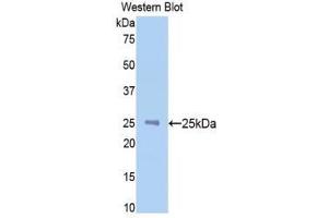 Western Blotting (WB) image for anti-N-Acetylgalactosaminidase, alpha (NAGA) (AA 218-415) antibody (ABIN1859956) (NAGA antibody  (AA 218-415))