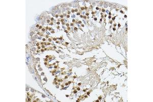 Immunohistochemistry of paraffin-embedded rat testis using PRDM14 Rabbit pAb (ABIN6128496, ABIN6146133, ABIN6146136 and ABIN6221189) at dilution of 1:100 (40x lens).