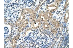 Image no. 1 for anti-Alanine Aminotransferase (ALT) (AA 81-130) antibody (ABIN320979) (ALT antibody  (AA 81-130))