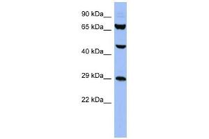SNRPB antibody used at 1 ug/ml to detect target protein. (SNRPB antibody  (N-Term))