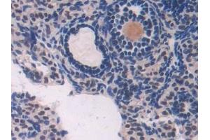 Detection of ADK in Mouse Ovary Tissue using Polyclonal Antibody to Adenosine Kinase (ADK)