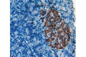 IHC-P analysis of Kidney tissue, with DAB staining. (iPLA2 antibody  (AA 481-702))