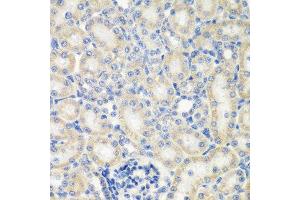 Immunohistochemistry of paraffin-embedded rat kidney using NAA50 antibody. (NAA50 antibody  (AA 1-169))