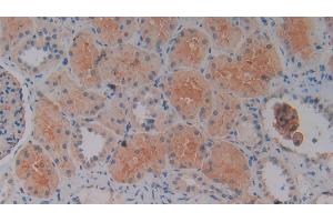 Immunohistochemistry (IHC) image for anti-Solute Carrier Family 9 (Sodium/hydrogen Exchanger), Member 3 Regulator 2 (SLC9A3R2) (AA 56-337) antibody (ABIN7442744)