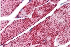Human Skeletal Muscle: Formalin-Fixed, Paraffin-Embedded (FFPE) (HSPA9 antibody  (C-Term))