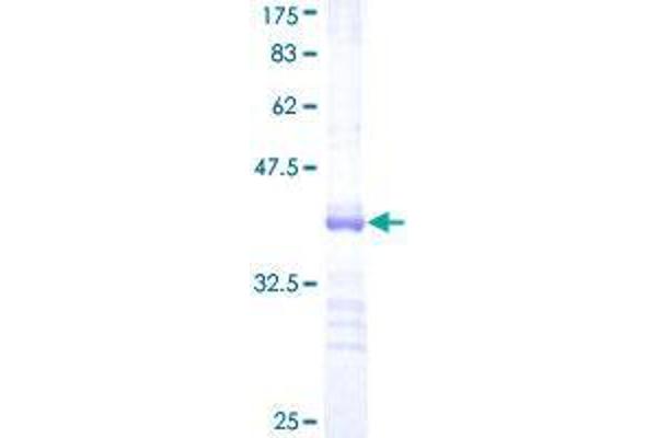 RNF125 Protein (AA 143-231) (GST tag)