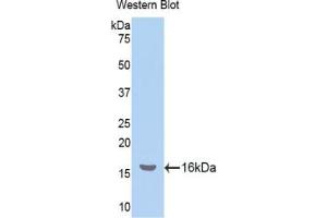 Detection of Recombinant NPM, Human using Polyclonal Antibody to Nucleophosmin 1 (NPM1) (NPM1 antibody  (AA 20-154))