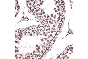 Immunohistochemistry of paraffin-embedded rat testis using HMGB2 Rabbit mAb (ABIN7267649) at dilution of 1:100 (40x lens). (HMGB2 antibody)