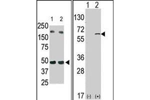 (LEFT) The SPHK1 polyclonal antibody  is used in Western blot (Lane 2) to detect c-myc-tagged SPHK1 in transfected 293 cell lysate (ac-myc antibody is used as control in Lane 1). (SPHK1 antibody  (N-Term))