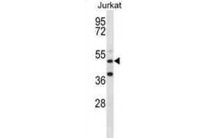 Western Blotting (WB) image for anti-RNA Binding Motif Protein 22 (RBM22) antibody (ABIN2998337) (RBM22 antibody)