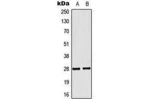 Western blot analysis of NKX2-6 expression in MCF7 (A), COLO205 (B) whole cell lysates.