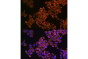 Immunofluorescence analysis of HeLa cells using SQLE Rabbit pAb (ABIN1513563, ABIN5664074, ABIN5664075, ABIN5664076 and ABIN6219540) at dilution of 1:100 (40x lens). (SQLE antibody  (AA 143-400))