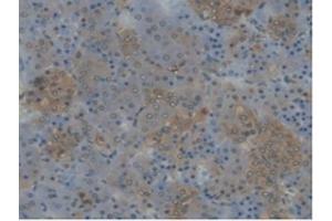 Detection of CYP17A1 in Rat Adrenal gland Tissue using Polyclonal Antibody to Cytochrome P450 17A1 (CYP17A1) (CYP17A1 antibody  (AA 201-507))