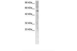 Image no. 3 for anti-Zinc Finger Protein 500 (ZNF500) (AA 348-397) antibody (ABIN6735775)