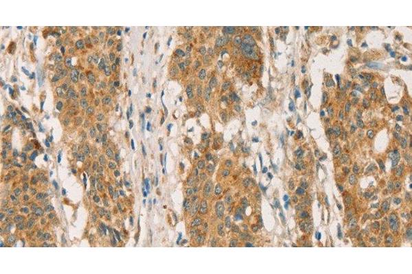 Retinoblastoma Binding Protein 8 antibody