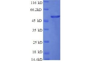 SDS-PAGE (SDS) image for Fibrinogen alpha Chain (FGA) (AA 36-218) protein (His tag) (ABIN5709513)